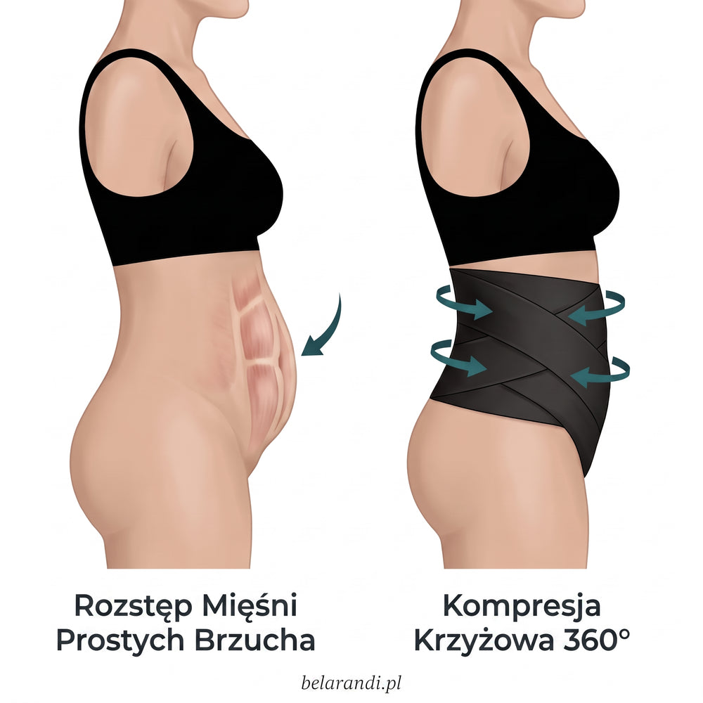 Rozejście mięśnia prostego a krzyżowa kompresja 360°