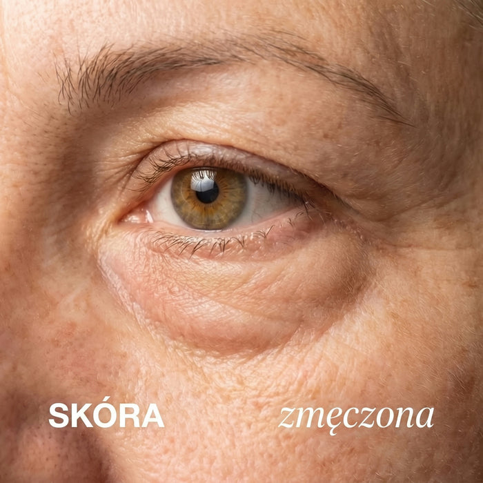 Skóra zmęczona
