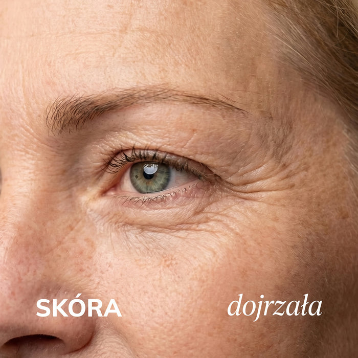 Skóra dojrzała